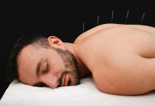 5 Best Acupuncturists in Charlotte
