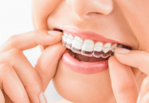 5 Best Orthodontists in Charlotte