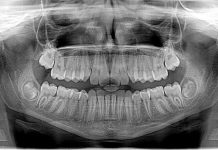 5 Best Orthodontists in Phoenix