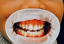 5 Best Orthodontists in San Antonio