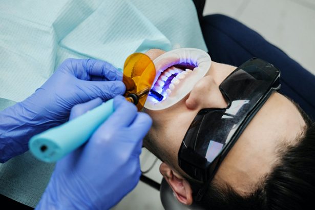 5 Best Cosmetic Dentists in San Francisco