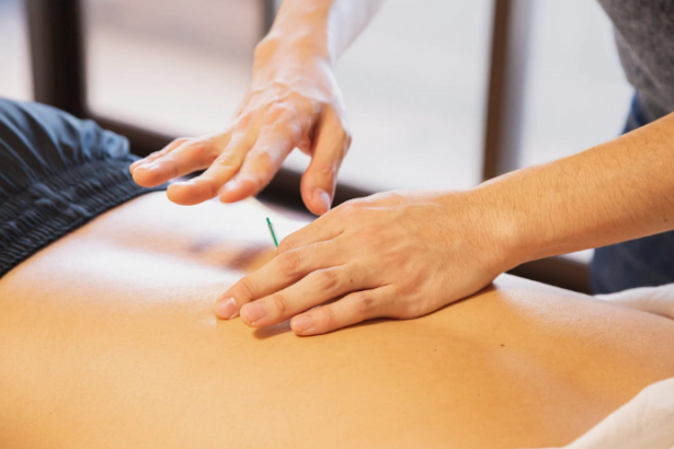 5 Best Acupuncture in Fort Worth