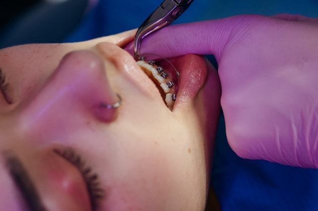 An orthodontist with a tool in a patients mouth fitting braces.