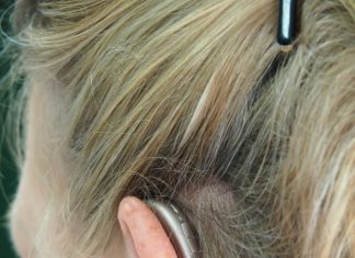 Best Audiologists in San Diego, CA