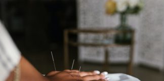 5 Best Acupuncture in San Francisco