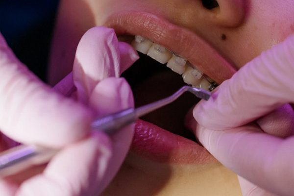 Top Orthodontists in Fresno