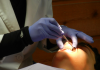 Best Orthodontists in Atlanta