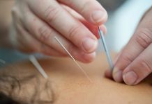 5 Best Acupuncture in Denver