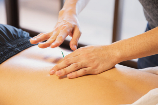 Top Acupuncture in St. Louis