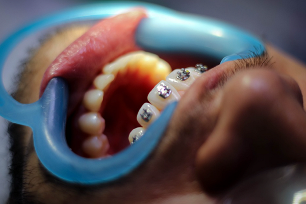 Top Orthodontists in El Paso