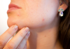 Best Dermatologists in Oklahoma City