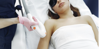 Best Hair Removal in St. Louis