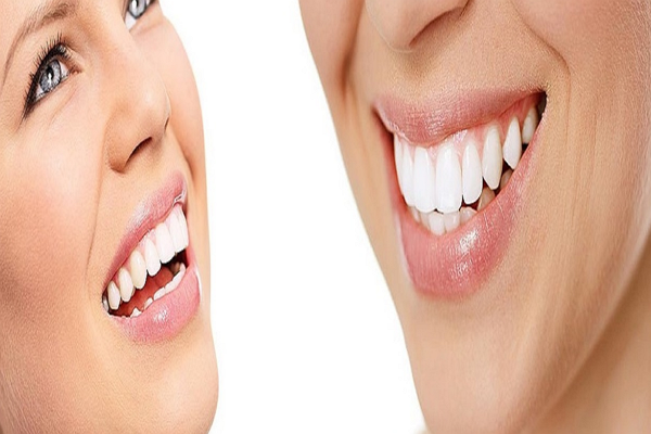Good Cosmetic Dentists in Boston