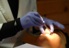 Best Orthodontists in Minneapolis