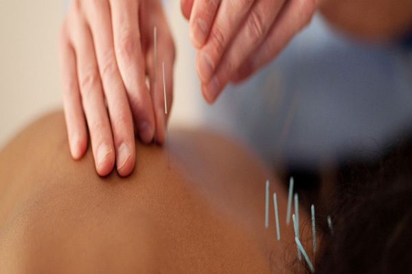 One of the best Acupuncture in Raleigh