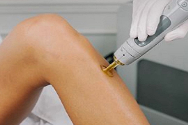 Good Hair Removal in Tulsa