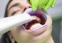 5 Best Orthodontists in Aurora
