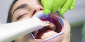 5 Best Orthodontists in Aurora