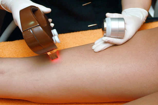 Best Hair Removal in New Orleans
