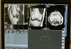 5 Best Radiologists in Omaha, NE