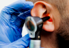 Best Audiologists in Long Beach