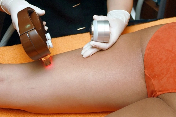 Hair Removal in Tampa