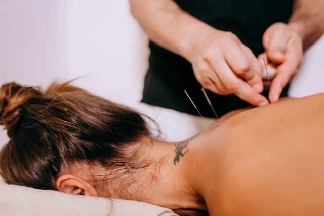 5 Best Acupuncture in Cleveland, OH