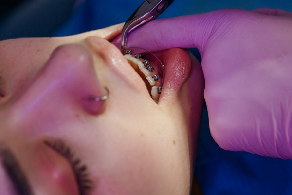 Top Orthodontists in New Orleans