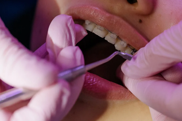 Good Orthodontists in New Orleans
