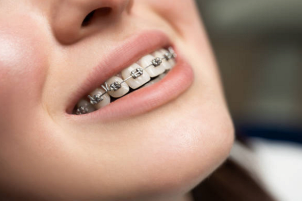 Top Orthodontists in Omaha