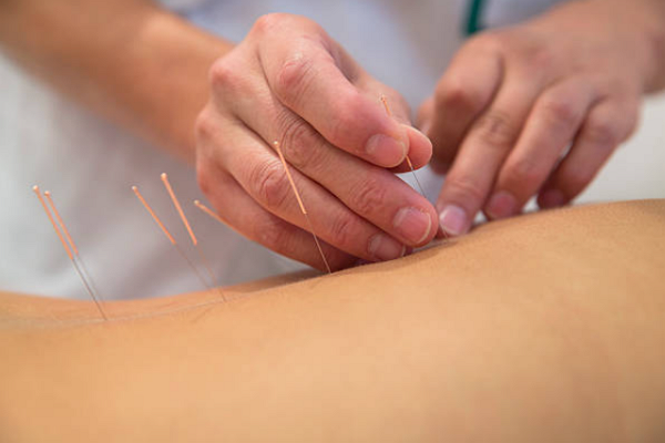 One of the best Acupuncture in Tulsa