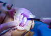 Best Orthodontists in Santa Ana