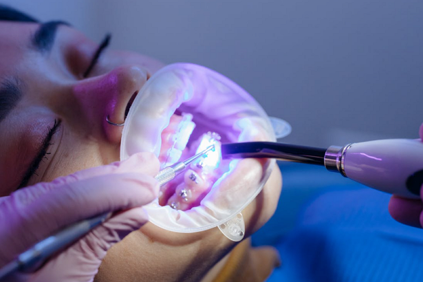 Best Orthodontists in Santa Ana